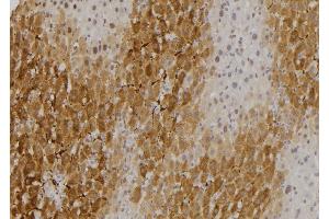 ABIN6275320 at 1/100 staining Rat liver tissue by IHC-P. (NCOA4 抗体  (C-Term))