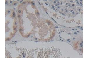 Detection of ABCC8 in Human Kidney Tissue using Polyclonal Antibody to ATP Binding Cassette Transporter C8 (ABCC8) (ABCC8 抗体  (AA 679-929))