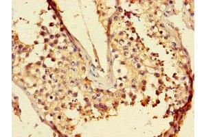 Immunohistochemistry of paraffin-embedded human testis tissue using ABIN7158030 at dilution of 1:100 (LZTFL1 抗体  (AA 116-299))