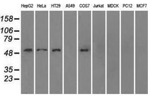 Western blot analysis of extracts (35 µg) from 9 different cell lines by using anti-SLC2A5 monoclonal antibody. (SLC2A5 抗体)