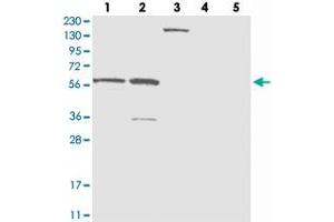 Western blot analysis of Lane 1: RT-4, Lane 2: U-251 MG, Lane 3: Human Plasma, Lane 4: Liver, Lane 5: Tonsil with ZNF250 polyclonal antibody  at 1:250-1:500 dilution. (ZNF250 抗体)