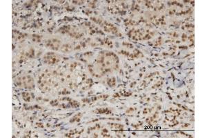Immunoperoxidase of monoclonal antibody to DDB1 on formalin-fixed paraffin-embedded human adrenal gland. (DDB1 抗体  (AA 1044-1140))