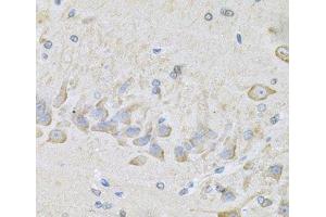 Immunohistochemistry of paraffin-embedded Mouse brain using RhoA Polyclonal Antibody at dilution of 1:100 (40x lens). (RHOA 抗体)