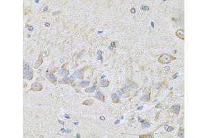 Immunohistochemistry of paraffin-embedded Mouse brain using RhoA Polyclonal Antibody at dilution of 1:100 (40x lens). (RHOA 抗体)