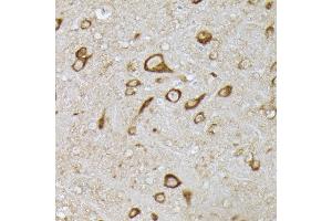 Immunohistochemistry of paraffin-embedded mouse brain using [KO Validated] PHD2 Rabbit pAb (ABIN7266909) at dilution of 1:150 (40x lens).