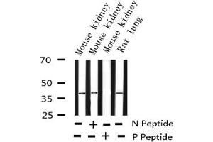 Western blot analysis of Phospho-c-Jun (Ser73) expression in various lysates