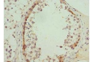 Immunohistochemistry of paraffin-embedded human testis tissue using ABIN7144880 at dilution of 1:100 (ABCA3 抗体  (AA 43-203))