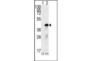 Western blot analysis of SOX2 (arrow) using rabbit polyclonal SOX2 Antibody f. (SOX2 抗体)