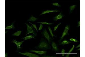 Immunofluorescence (IF) image for anti-Galectin 3 (LGALS3) (AA 1-250) antibody (ABIN1326929)