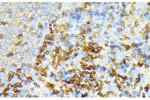 Immunohistochemistry of paraffin-embedded Rat spleen using SPTA1 Polyclonal Antibody at dilution of 1:100 (40x lens). (SPTA1 抗体)