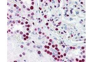 Immunohistochemistry (IHC) image for anti-Polypyrimidine Tract Binding Protein 1 (PTBP1) antibody (ABIN2665344) (PTBP1 抗体)