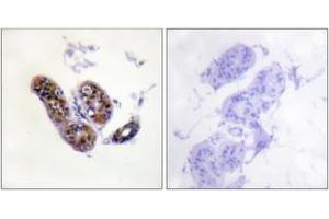 Immunohistochemistry (IHC) image for anti-Microphthalmia-Associated Transcription Factor (MITF) (AA 151-200) antibody (ABIN2888676) (MITF 抗体  (AA 151-200))