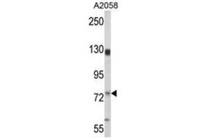 Western blot analysis of MCAM Antibody (MCAM 抗体  (Middle Region))