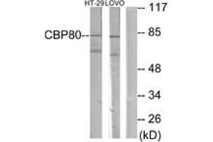 Western blot analysis of extracts from HT-29/LOVO cells, using NCBP1 Antibody. (NCBP1 抗体  (AA 1-50))