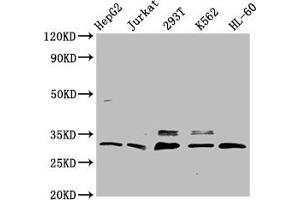 Western Blot Positive WB detected in: HepG2 whole cell lysate, Jurkat whole cell lysate, 293T whole cell lysate, K562 whole cell lysate, HL-60 whole cell lysate All lanes: GEMIN2 antibody at 3. (SIP1 抗体  (AA 1-280))