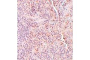 Immunohistochemistry (IHC) image for anti-Sequestosome 1 (SQSTM1) (C-Term) antibody (ABIN1030699) (SQSTM1 抗体  (C-Term))