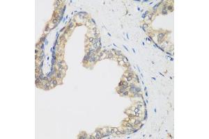 Immunohistochemistry of paraffin-embedded human prostate using NCBP2 antibody (ABIN5974395) at dilution of 1/200 (40x lens). (NCBP2 抗体)