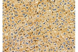 ABIN6261392 and ABIN6279339 at 1/100 staining mouse liver tissue by IHC-P. (DYNC1I2 抗体  (N-Term))