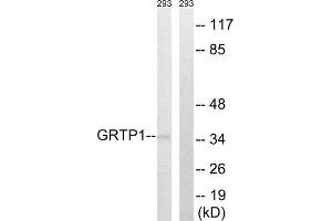 Western Blotting (WB) image for anti-Growth Hormone Regulated TBC Protein 1 (GRTP1) (Internal Region) antibody (ABIN1851386) (GRTP1 抗体  (Internal Region))
