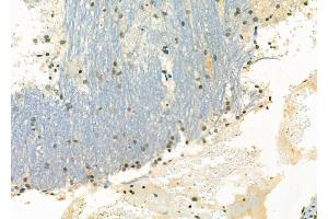 ABIN6263648 and ABIN6266600 at 1/100 staining Rat brain tissue by IHC-P.