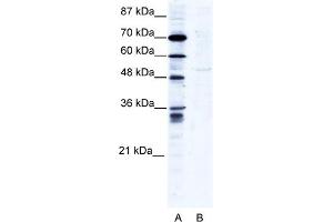 WB Suggested Anti-ZNF134 Antibody Titration:  2. (ZNF134 抗体  (N-Term))
