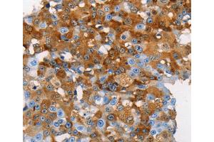 Immunohistochemistry (IHC) image for anti-Mucin 5 Subtype B (MUC5B) antibody (ABIN2432112) (MUC5B 抗体)