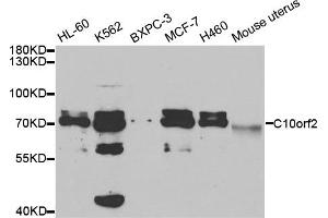 Western Blotting (WB) image for anti-Chromosome 10 Open Reading Frame 2 (C10ORF2) antibody (ABIN1876491)