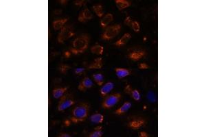 Immunofluorescence analysis of U-2 OS cells using TENM1 antibody (ABIN7270767) at dilution of 1:100. (ODZ1/Teneurin 1 抗体  (AA 350-540))