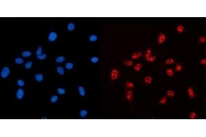 IF analysis of AKAP 95/AKAP8 using anti-AKAP 95/AKAP8 antibody (ABIN7601553).