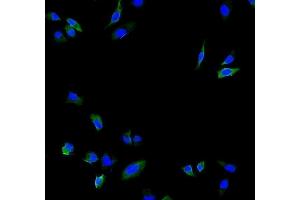 IF analysis of Calpain 2 using anti-Calpain 2 antibody (ABIN5518897).
