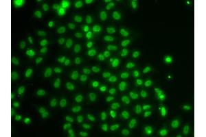 Immunofluorescence analysis of U2OS cells using TOX antibody (ABIN5974241). (TOX 抗体)
