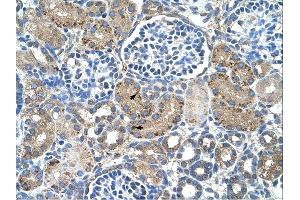 Immunohistochemistry (IHC) image for anti-Glutaminase 2 (Liver, Mitochondrial) (GLS2) (Middle Region) antibody (ABIN2781319) (GLS2 抗体  (Middle Region))