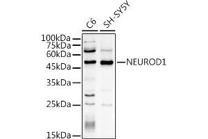 Western blot analysis of extracts of various cell lines, using NEUROD1 antibody (ABIN3021547, ABIN3021548, ABIN3021549, ABIN1513255 and ABIN6215228) at 1:500 dilution. (NEUROD1 抗体  (AA 1-70))
