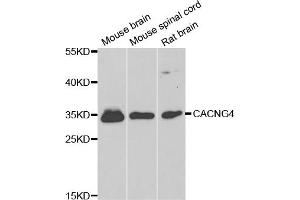 Western blot analysis of extracts of various cell lines, using CACNG4 antibody (ABIN5974747) at 1/1000 dilution. (CACNG4 抗体)
