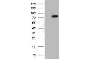 Western Blotting (WB) image for anti-rho GTPase Activating Protein 25 (ARHGAP25) antibody (ABIN1496709) (ARHGAP25 抗体)
