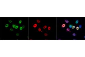 Immunofluorescence (IF) image for anti-Cyclin-Dependent Kinase 4 (CDK4) antibody (ABIN2855529)