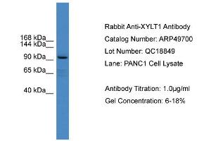 WB Suggested Anti-XYLT1  Antibody Titration: 0. (XYLT1 抗体  (Middle Region))