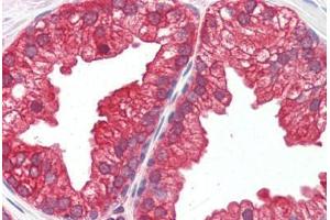 Human Prostate (formalin-fixed, paraffin-embedded) stained with MAP2K1 antibody ABIN461964 at 10 ug/ml followed by biotinylated goat anti-rabbit IgG secondary antibody ABIN481713, alkaline phosphatase-streptavidin and chromogen. (MEK1 抗体  (N-Term))