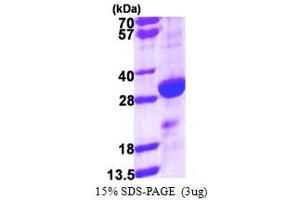 SDS-PAGE (SDS) image for Density-Regulated Protein (DENR) (AA 1-198) protein (His tag) (ABIN667552) (Density Regulated Protein Protein (AA 1-198) (His tag))