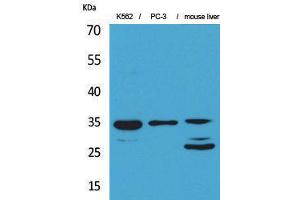 Western Blotting (WB) image for anti-Cell Division Cycle 34 (CDC34) (Internal Region) antibody (ABIN3178220) (CDC34 抗体  (Internal Region))