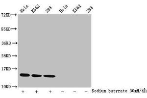Western Blot Detected samples: Hela whole cell lysate, K562 whole cell lysate, 293 whole cell lysate, Untreated (-) or treated (+) with 30 mM sodium butyrate for 4h All lanes: HIST1H2BC antibody at 1:1000 Secondary Goat polyclonal to rabbit IgG at 1/40000 dilution Predicted band size: 14 kDa Observed band size: 14 kDa (Histone H2B 抗体  (acLys15))
