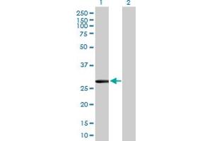 Western Blot analysis of CLIC2 expression in transfected 293T cell line by CLIC2 MaxPab polyclonal antibody. (CLIC2 抗体  (AA 1-247))