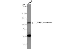WB Image Whole cell extract (30 μg) was separated by 7. (OGT 抗体  (N-Term))