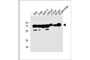 Western Blotting (WB) image for anti-Cystathionine-beta-Synthase (CBS) (AA 301-330) antibody (ABIN390947)