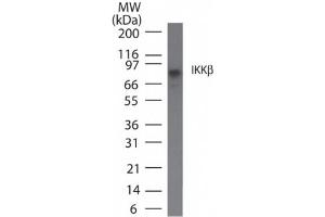 IKK beta IKK2 Western Blot.
