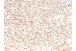 Immunohistochemistry (IHC) image for anti-Nuclear Factor of kappa Light Polypeptide Gene Enhancer in B-Cells Inhibitor, alpha (NFKBIA) (pSer32), (pSer36) antibody (ABIN6256292)