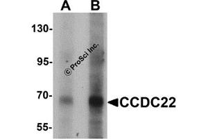 Western Blotting (WB) image for anti-Coiled-Coil Domain Containing 22 (CCDC22) (N-Term) antibody (ABIN1031304) (CCDC22 抗体  (N-Term))