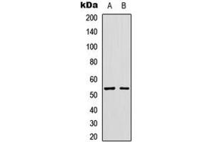 Western blot analysis of GLP-1 Receptor expression in SKNSH (A), HuvEc (B) whole cell lysates. (GLP1R 抗体  (Center))