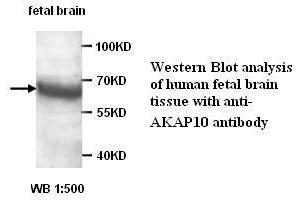 Image no. 1 for anti-A Kinase (PRKA) Anchor Protein 10 (AKAP10) antibody (ABIN1574557)