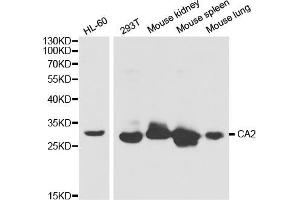 Western blot analysis of extracts of various cell lines, using CA2 antibody (ABIN5970672) at 1/1000 dilution. (CA2 抗体)